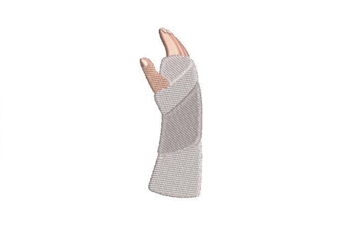 Hand in a Cast