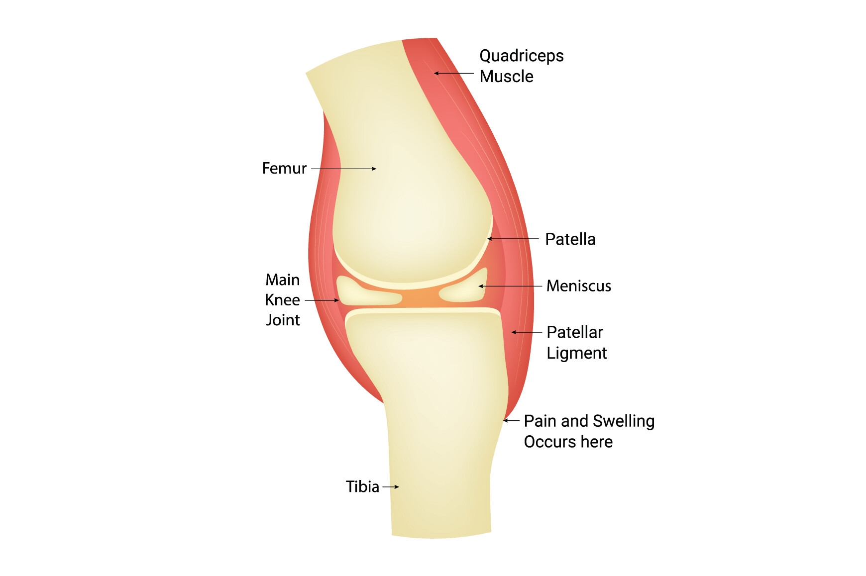 Quadriceps Muscle Science Design Vector Graphic by hamjaiu · Creative ...