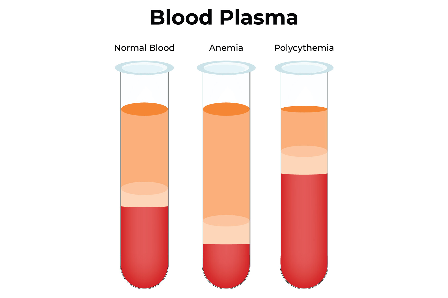 Blood Plasma Science Design Vector Graphic by hamjaiu · Creative Fabrica
