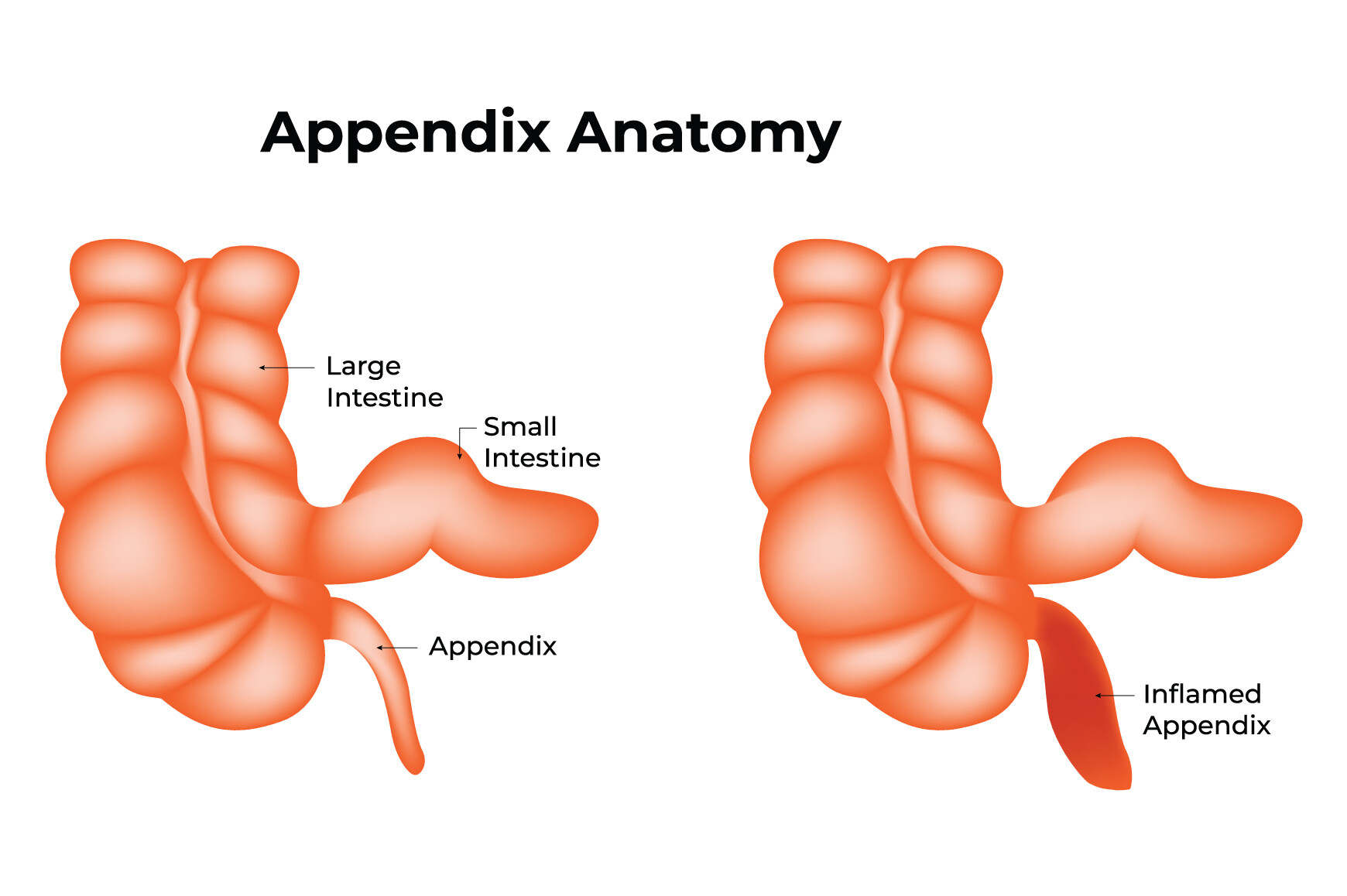 Appendix Anatomy Science Design Vector Graphic by hamjaiu · Creative ...
