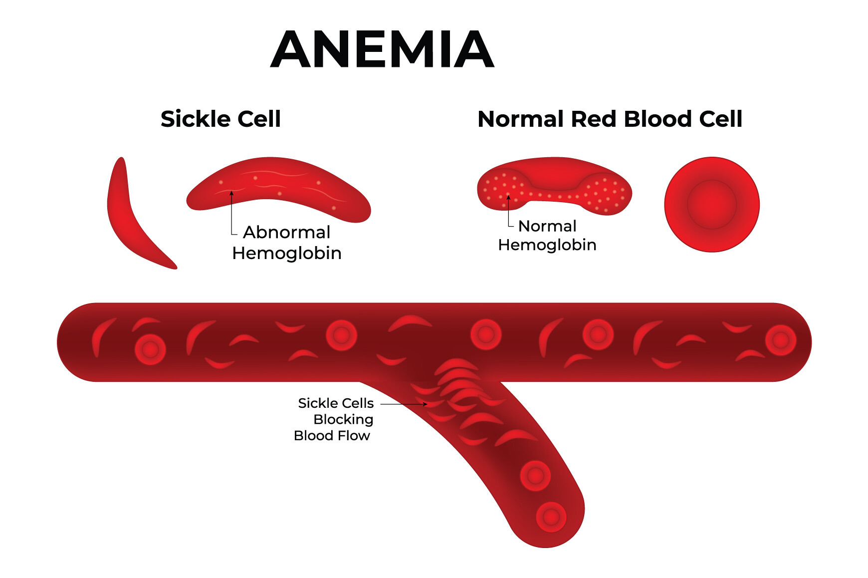 Anemia Science Design Vector Graphic by hamjaiu · Creative Fabrica