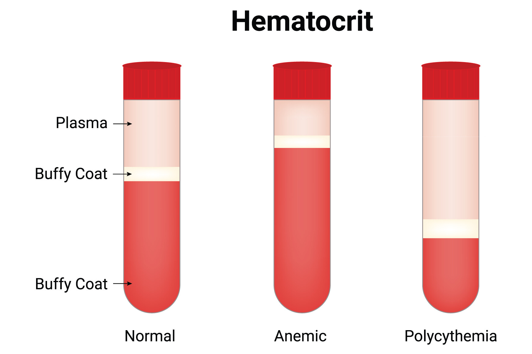 Hematocrit Science Design Vector Diagram Graphic by hamjaiu · Creative ...