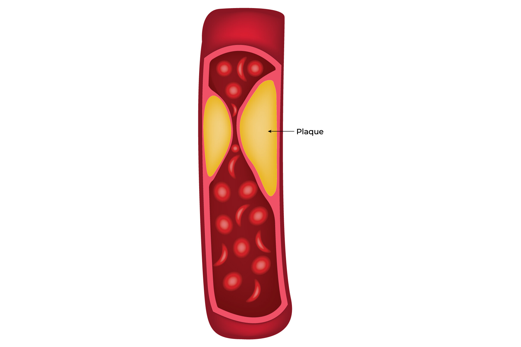 Plaque Science Design Vector Diagram Graphic by hamjaiu · Creative Fabrica
