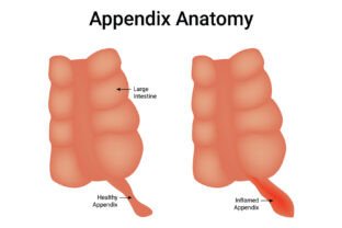 Appendix Anatomy Science Design Vector Graphic by hamjaiu · Creative ...