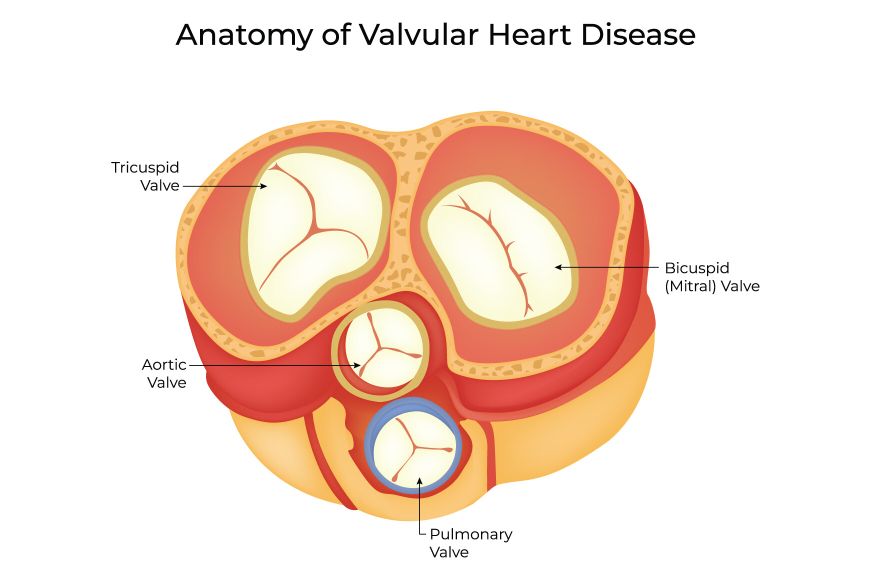 Valvar Anatomy of Valvular Heart Disease Design Graphic by hamjaiu · Creative ...