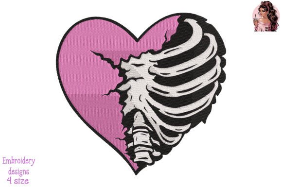 Breast Cancer Rib Cage