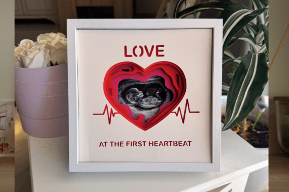 Ultrasound Photo Frame - 3D Shadow Box — photo 3