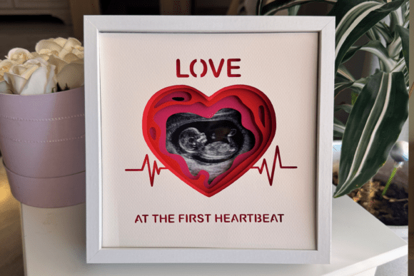 Ultrasound Photo Frame - 3D Shadow Box