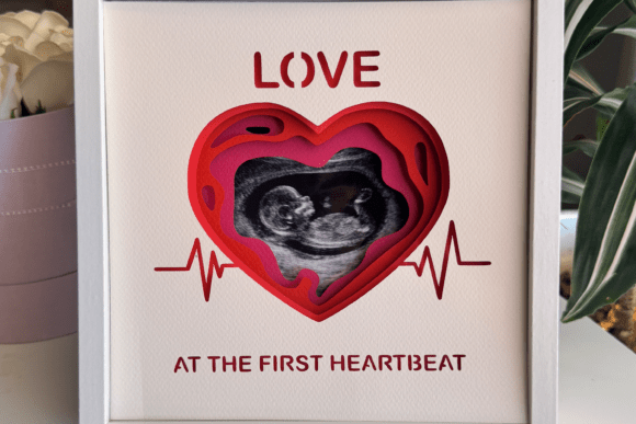 Ultrasound Photo Frame - 3D Shadow Box — photo 4